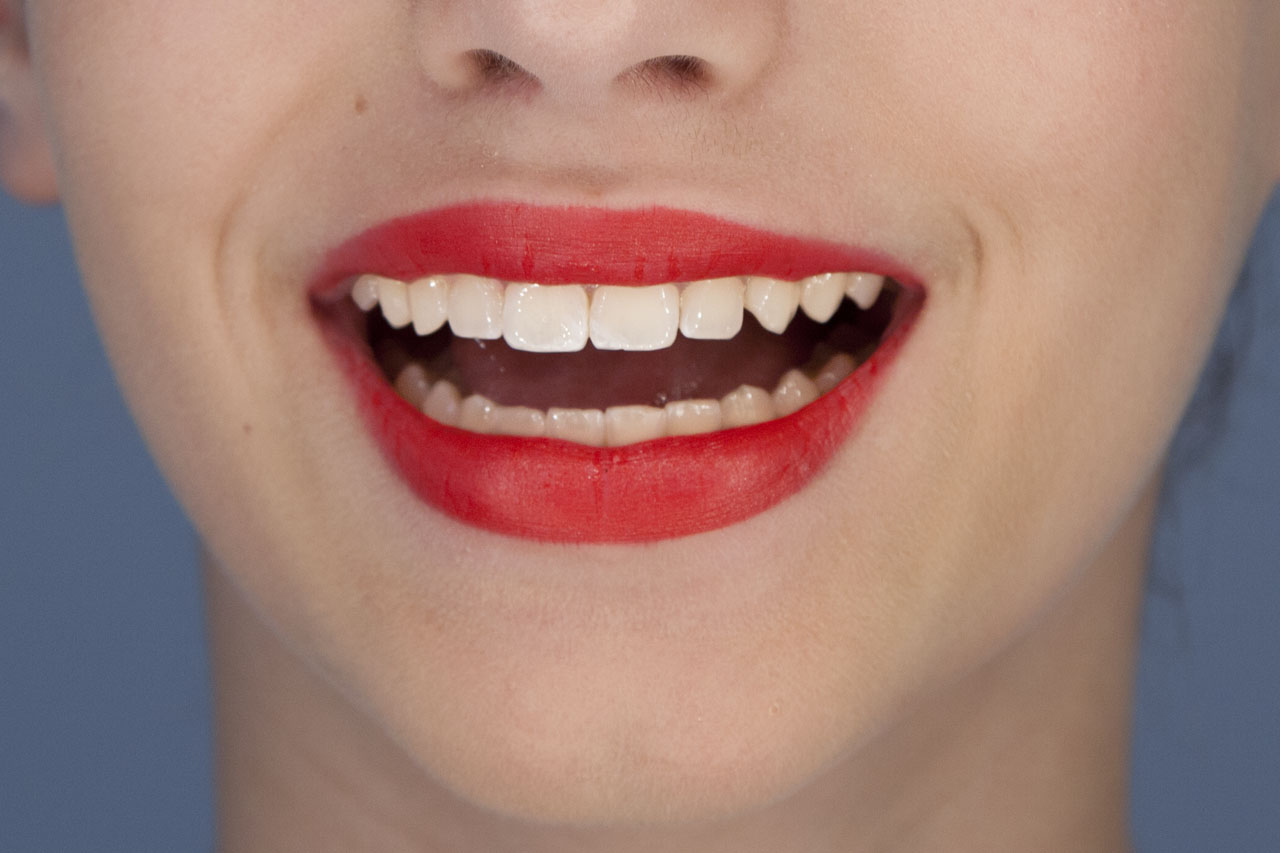 Ästhetische Zahnheilkunde - ein schönes Lächeln
